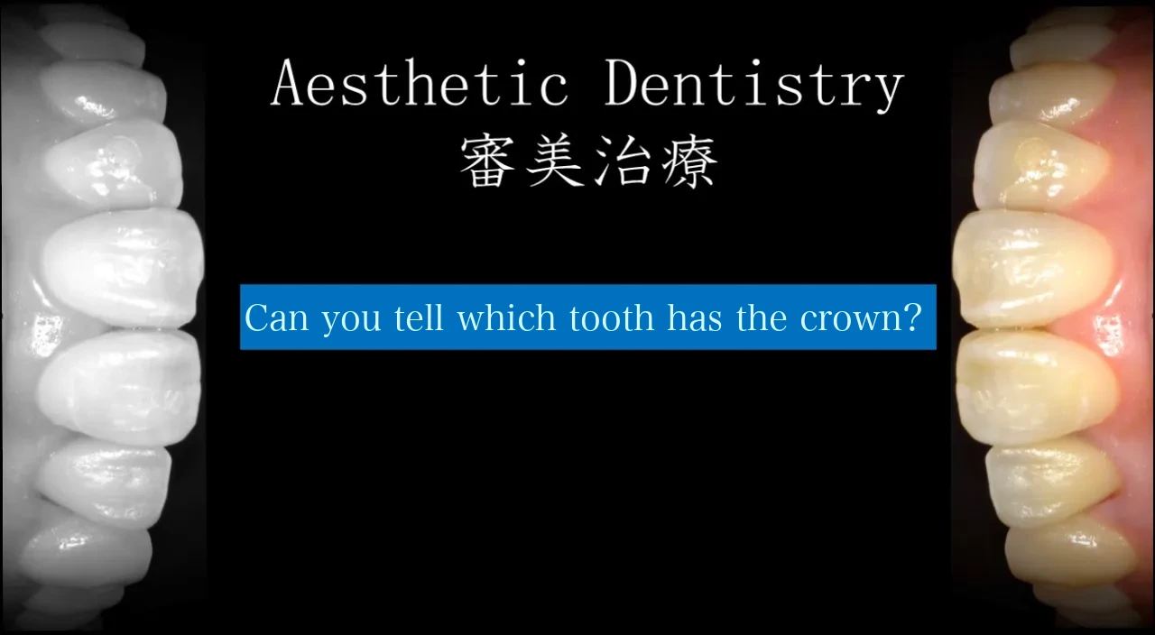 Cosmetic dentistry treatment case examples