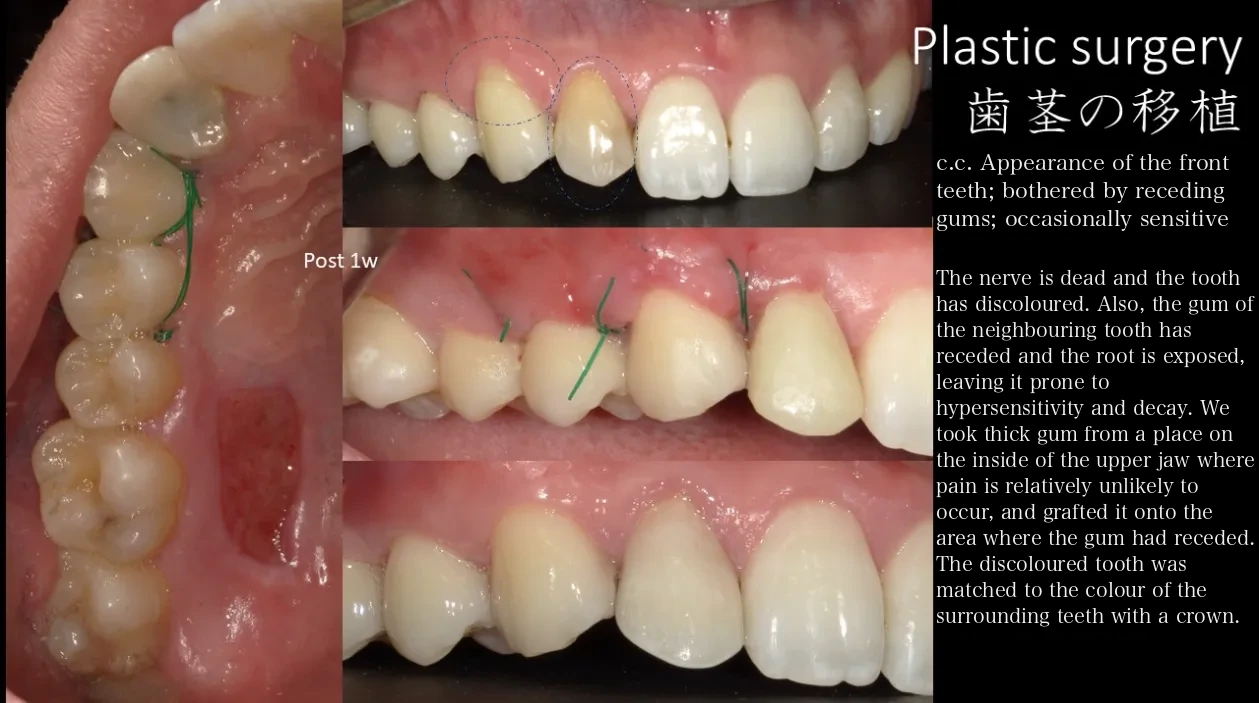Cosmetic dentistry treatment case examples