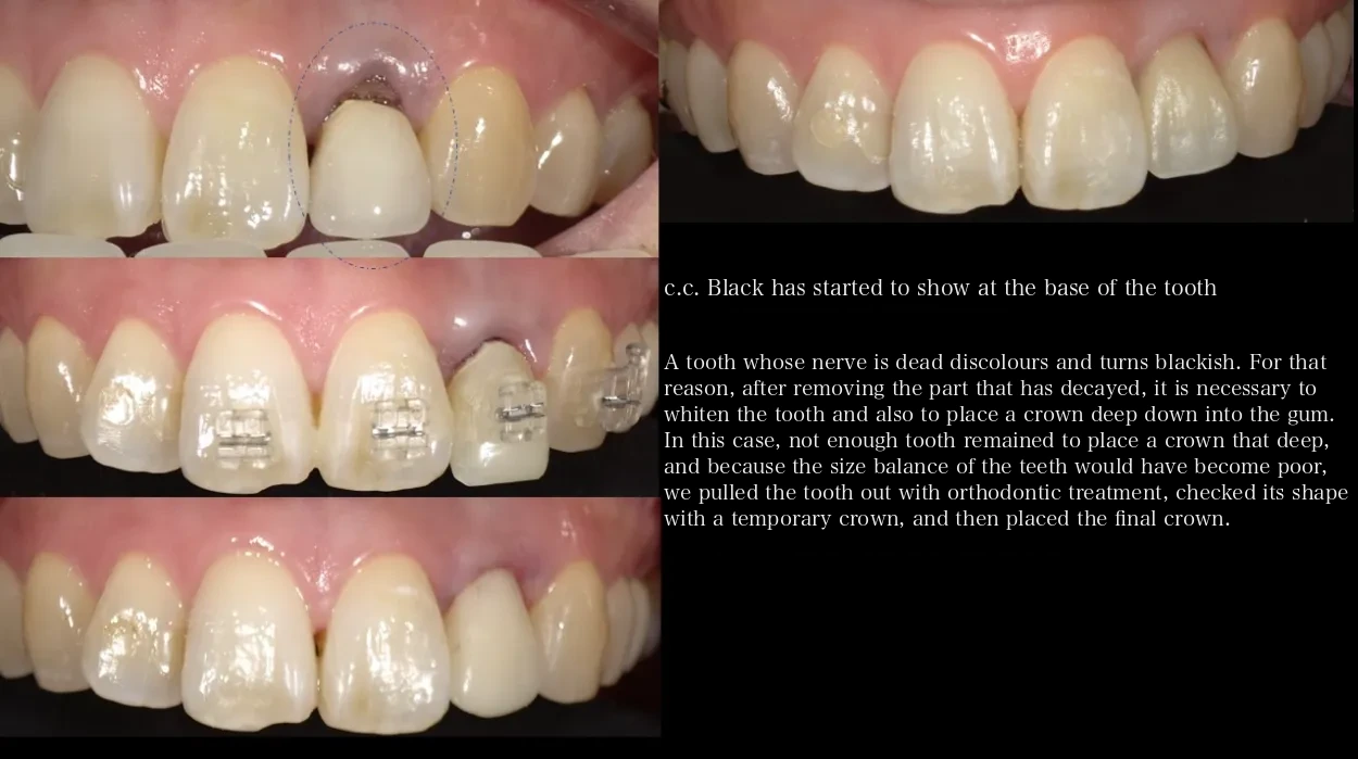 Cosmetic dentistry treatment case examples