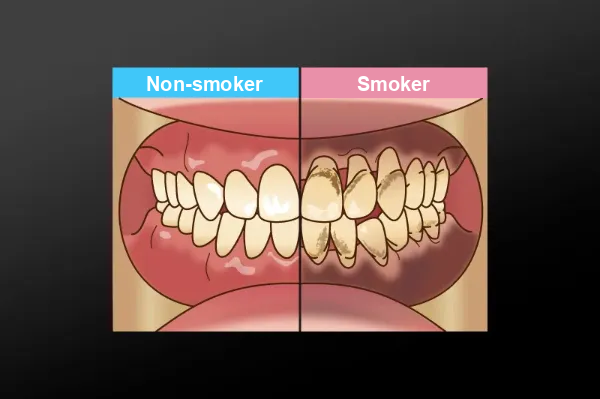 Lifestyle (smoking, irregular eating habits, etc.)