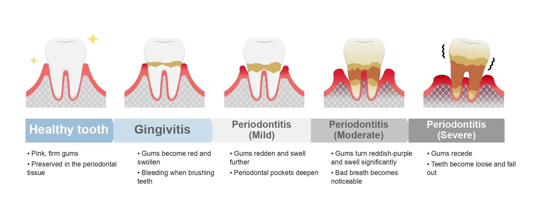 Is periodontal disease incurable?