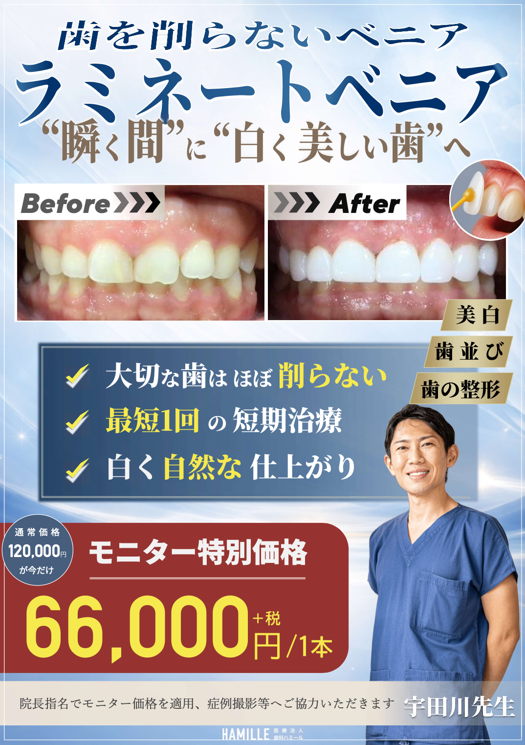 4月スタート】歯を削らない「ラミネートベニア」特別モニター募集の